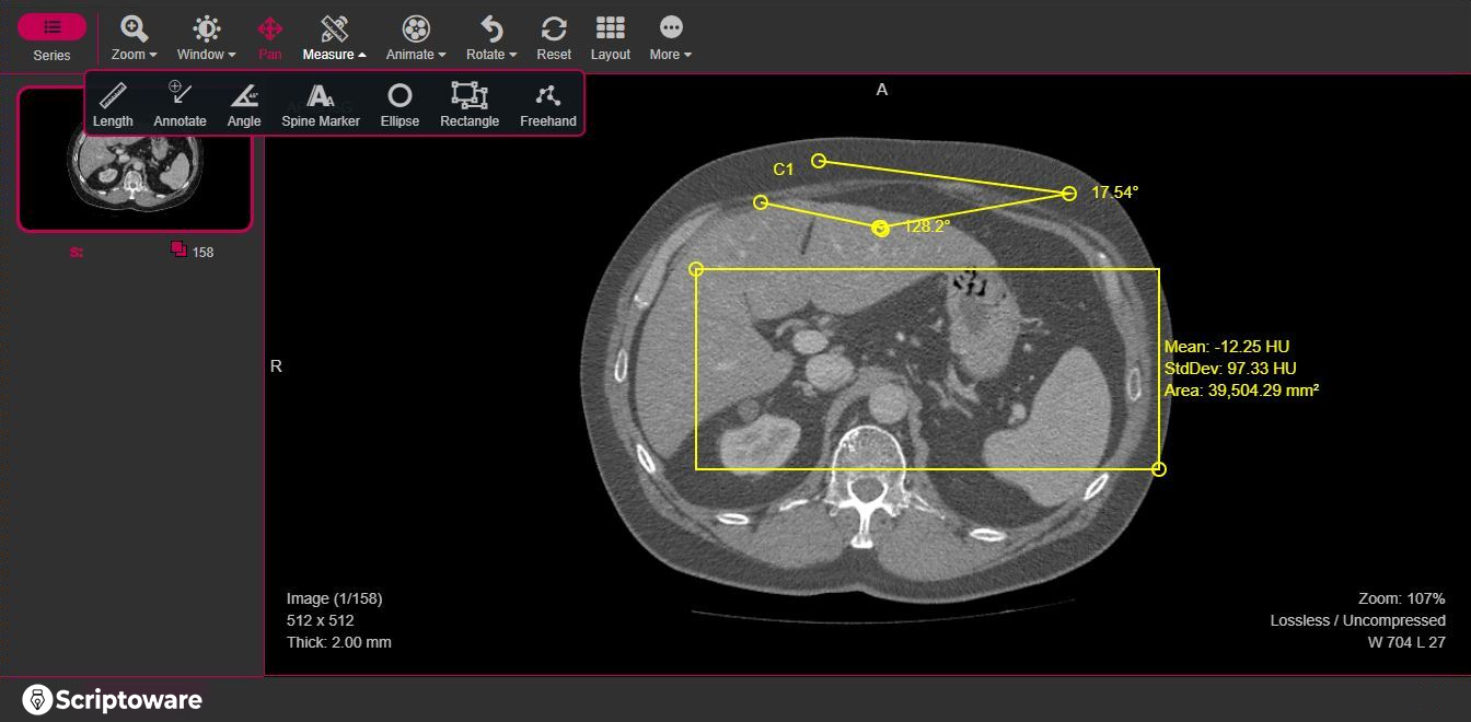 Using tools to view, modify an image of the brain with a DICOM Viewer